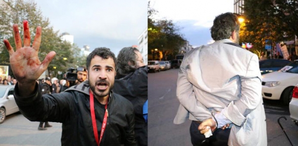 Gazetecilere de müdahale