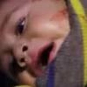 ESEDDEN KİMYASAL KATLİAM