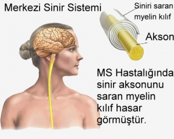 MS gençleri vuruyor