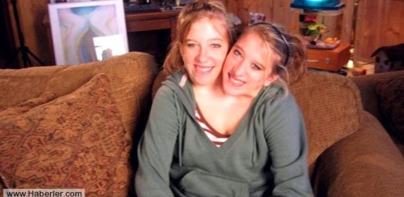 Tek Vücutta İki Kişi Yaşıyorlar 