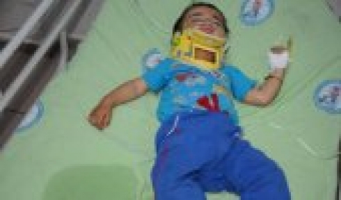 Üzerine Televizyon Düşen Çocuk Yaralandı